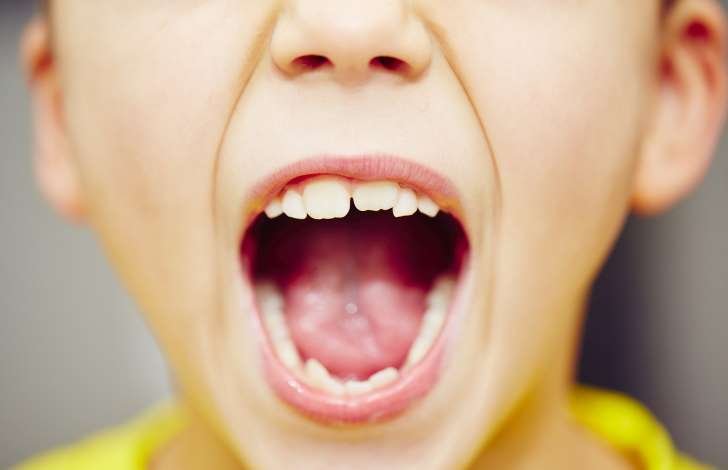 Você sabe quantos dentes temos ao longo da vida? Entenda cada fase